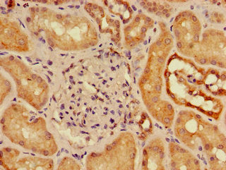 Immunohistochemistry of paraffin-embedded human kidney tissue using SLC16A9 Antibody at dilution of 1:100Rabbit anti-Human SLC16A9 Polyclonal Antibody