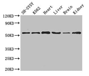 Western Blot | Positive WB detected in: SH-SY5Y whole cell lysate, K562 whole cell lysate, Mouse heart tissue, Mouse liver tissue, Mouse brain tissue, Mouse kidney tissue | All lanes: SLC16A9 antibody at 3.5μg/ml | Secondary | Goat polyclonal to rabbit IgG at 1/50000 dilution | Predicted band size: 56 kDa | Observed band size: 56 kDaRabbit anti-Human SLC16A9 Polyclonal Antibody