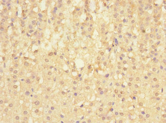Immunohistochemistry of paraffin-embedded human adrenal gland tissue using SIGIRR Antibody at dilution of 1:100Rabbit anti-Human SIGIRR Polyclonal Antibody