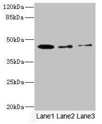 Western blot  | All lanes: SIGIRR antibody at 1.77µg/ml  | Lane 1: Mouse liver tissue  | Lane 2: Mouse kidney tissue  | Lane 3: MCF-7 whole cell lysate  | Secondary  | Goat polyclonal to rabbit IgG at 1/10000 dilution  | Predicted band size: 46, 56 kDa  | Observed band size: 46 kDaRabbit anti-Human SIGIRR Polyclonal Antibody