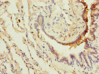 Immunohistochemistry of paraffin-embedded human lung tissue using LRRC8E Antibody at dilution of 1:100