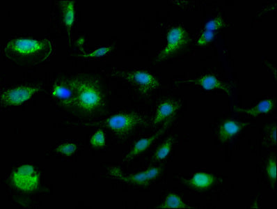 Immunofluorescence staining of U251 cells with SLC25A24 Antibody at 1:110, counter-stained with DAPI. The cells were fixed in 4% formaldehyde, permeabilized using 0.2% Triton X-100 and blocked in 10% normal Goat Serum. The cells were then incubated with the antibody overnight at 4°C. The secondary antibody was Alexa Fluor 488-congugated AffiniPure Goat Anti-Rabbit IgG(H+L).Rabbit anti-Human SLC25A24 Polyclonal Antibody