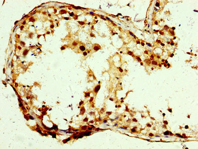 IHC image of SLC25A24 Antibody diluted at 1:250 and staining in paraffin-embedded human testis tissue performed on a Leica BondTM system. After dewaxing and hydration, antigen retrieval was mediated by high pressure in a citrate buffer (pH 6.0). Section was blocked with 10% normal goat serum 30min at RT. Then primary antibody (1% BSA) was incubated at 4°C overnight. The primary is detected by a biotinylated secondary antibody and visualized using an HRP conjugated SP system.Rabbit anti-Human SLC25A24 Polyclonal Antibody