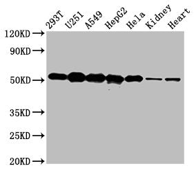 Western Blot  | Positive WB detected in: 293T whole cell lysate, U251 whole cell lysate, A549 whole cell lysate, HepG2 whole cell lysate, Hela whole cell lysate, Rat kidney tissue, Mouse heart tissue  | All lanes: SLC25A24 antibody at 5µg/ml  | Secondary  | Goat polyclonal to rabbit IgG at 1/50000 dilution  | Predicted band size: 54, 52 kDa  | Observed band size: 54 kDaRabbit anti-Human SLC25A24 Polyclonal Antibody