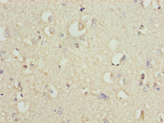 Immunohistochemistry of paraffin-embedded human brain tissue using SLC30A6 Antibody at dilution of 1:100Rabbit anti-Human SLC30A6 Polyclonal Antibody