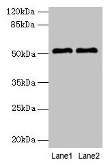 Western blot  | All lanes: SLC30A6 antibody at 6µg/ml  | Lane 1: A549 whole cell lysate  | Lane 2: U251 whole cell lysate  | Secondary  | Goat polyclonal to rabbit IgG at 1/10000 dilution  | Predicted band size: 52, 56, 48, 49 kDa  | Observed band size: 52 kDaRabbit anti-Human SLC30A6 Polyclonal Antibody