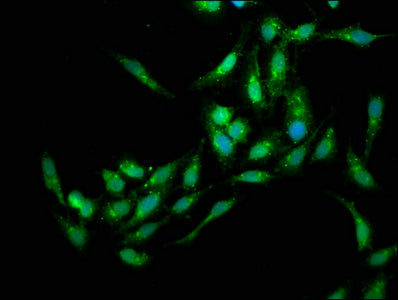 Immunofluorescence staining of Hela cells with EDC4 Antibody at 1:133, counter-stained with DAPI. The cells were fixed in 4% formaldehyde, permeabilized using 0.2% Triton X-100 and blocked in 10% normal Goat Serum. The cells were then incubated with the antibody overnight at 4°C. The secondary antibody was Alexa Fluor 488-congugated AffiniPure Goat Anti-Rabbit IgG(H+L).Rabbit anti-Human EDC4 Polyclonal Antibody
