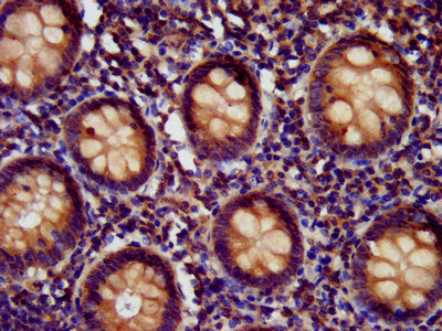 IHC image of the antibody diluted at 1:400 and staining in paraffin-embedded human appendix tissue performed on a Leica BondTM system. After dewaxing and hydration, antigen retrieval was mediated by high pressure in a citrate buffer (pH 6.0). Section was blocked with 10% normal goat serum 30min at RT. Then primary antibody (1% BSA) was incubated at 4°C overnight. The primary is detected by a biotinylated secondary antibody and visualized using an HRP conjugated SP system.Rabbit anti-Human EDC4 Polyclonal Antibody
