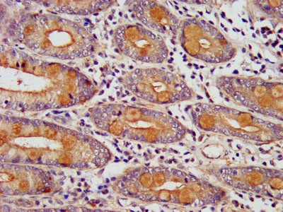 IHC image of EDC4 Antibody diluted at 1:400 and staining in paraffin-embedded human small intestine tissue performed on a Leica BondTM system. After dewaxing and hydration, antigen retrieval was mediated by high pressure in a citrate buffer (pH 6.0). Section was blocked with 10% normal goat serum 30min at RT. Then primary antibody (1% BSA) was incubated at 4°C overnight. The primary is detected by a biotinylated secondary antibody and visualized using an HRP conjugated SP system.Rabbit anti-Human EDC4 Polyclonal Antibody