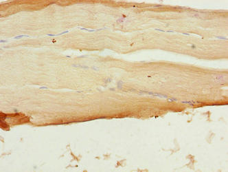 Immunohistochemistry of paraffin-embedded human skeletal muscle tissue using SFXN4 Antibody at dilution of 1:100Rabbit anti-Human SFXN4 Polyclonal Antibody