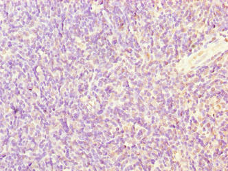 Immunohistochemistry of paraffin-embedded human thymus tissue using SFXN4 Antibody at dilution of 1:100Rabbit anti-Human SFXN4 Polyclonal Antibody