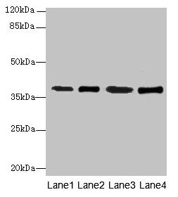 Western blot  | All lanes: SFXN4 antibody at 0.3µg/ml  | Lane 1: K562 whole cell lysate  | Lane 2: U251 whole cell lysate  | Lane 3: U87 whole cell lysate  | Lane 4: A549 whole cell lysate  | Secondary  | Goat polyclonal to rabbit IgG at 1/10000 dilution  | Predicted band size: 38, 35, 25 kDa  | Observed band size: 38 kDaRabbit anti-Human SFXN4 Polyclonal Antibody