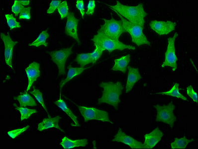 Immunofluorescence staining of SH-SY5Y cells with WDR73 Antibody at 1:50, counter-stained with DAPI. The cells were fixed in 4% formaldehyde, permeabilized using 0.2% Triton X-100 and blocked in 10% normal Goat Serum. The cells were then incubated with the antibody overnight at 4°C. The secondary antibody was Alexa Fluor 488-congugated AffiniPure Goat Anti-Rabbit IgG(H+L).Rabbit anti-Human WDR73 Polyclonal Antibody