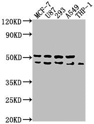 Western Blot | Positive WB detected in: MCF-7 whole cell lysate, U87 whole cell lysate, 293 whole cell lysate, A549 whole cell lysate, THP-1 whole cell lysate | All lanes: WDR73 antibody at 1:1000 | Secondary | Goat polyclonal to rabbit IgG at 1/50000 dilution | Predicted band size: 42 kDa | Observed band size: 42 kDaRabbit anti-Human WDR73 Polyclonal Antibody