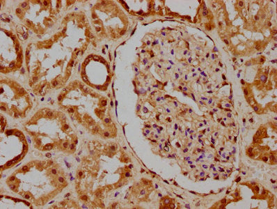 IHC image of PKN3 Antibody diluted at 1:300 and staining in paraffin-embedded human kidney tissue performed on a Leica BondTM system. After dewaxing and hydration, antigen retrieval was mediated by high pressure in a citrate buffer (pH 6.0). Section was blocked with 10% normal goat serum 30min at RT. Then primary antibody (1% BSA) was incubated at 4°C overnight. The primary is detected by a biotinylated secondary antibody and visualized using an HRP conjugated SP system.Rabbit anti-Human PKN3 Polyclonal Antibody