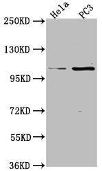 Western Blot | Positive WB detected in: Hela whole cell lysate, PC3 whole cell lysate | All lanes: PKN3 antibody at 1:2000 | Secondary | Goat polyclonal to rabbit IgG at 1/50000 dilution | Predicted band size: 100 kDa | Observed band size: 100 kDaRabbit anti-Human PKN3 Polyclonal Antibody