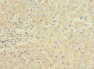 Immunohistochemistry of paraffin-embedded human liver tissue using LRRC31 Antibody at dilution of 1:100