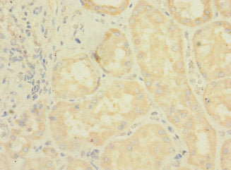 Immunohistochemistry of paraffin-embedded human kidney tissue using LRRC31 Antibody at dilution of 1:100