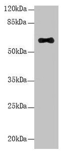 Western Blot  | All lanes: LRRC31 antibody at 5µg/ml + Mouse small intestine tissue  | Secondary  | Goat polyclonal to rabbit IgG at 1/10000 dilution  | Predicted band size: 62, 56, 39, 49 kDa  | Observed band size: 62 kDa