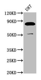 Western Blot  | Positive WB detected in: U87 whole cell lysate  | All lanes: FRMD7 antibody at 3.7µg/ml  | Secondary  | Goat polyclonal to rabbit IgG at 1/50000 dilution  | Predicted band size: 82, 80 kDa  | Observed band size: 82 kDaRabbit anti-Human FRMD7 Polyclonal Antibody