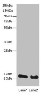 Western blot | All lanes: HIST2H3A antibody at 14 μg/ml | Lane 1: Mouse liver tissue | Lane 2: Mouse kidney tissue | Secondary | Goat polyclonal to rabbit IgG at 1/10000 dilution | Predicted band size: 15 kDa | Observed band size: 15 kDaRabbit anti-Human HIST2H3A Polyclonal Antibody
