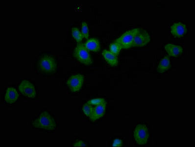 Immunofluorescence staining of HepG2 cells with RHOU Antibody at 1:166, counter-stained with DAPI. The cells were fixed in 4% formaldehyde, permeabilized using 0.2% Triton X-100 and blocked in 10% normal Goat Serum. The cells were then incubated with the antibody overnight at 4°C. The secondary antibody was Alexa Fluor 488-congugated AffiniPure Goat Anti-Rabbit IgG(H+L).Rabbit anti-Human RHOU Polyclonal Antibody