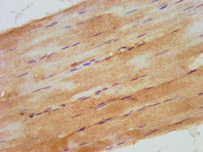 IHC image of the antibody diluted at 1:500 and staining in paraffin-embedded human skeletal muscle tissue performed on a Leica BondTM system. After dewaxing and hydration, antigen retrieval was mediated by high pressure in a citrate buffer (pH 6.0). Section was blocked with 10% normal goat serum 30min at RT. Then primary antibody (1% BSA) was incubated at 4°C overnight. The primary is detected by a biotinylated secondary antibody and visualized using an HRP conjugated SP system.Rabbit anti-Human RHOU Polyclonal Antibody