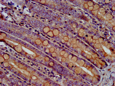 IHC image of RHOU Antibody diluted at 1:500 and staining in paraffin-embedded human small intestine tissue performed on a Leica BondTM system. After dewaxing and hydration, antigen retrieval was mediated by high pressure in a citrate buffer (pH 6.0). Section was blocked with 10% normal goat serum 30min at RT. Then primary antibody (1% BSA) was incubated at 4°C overnight. The primary is detected by a biotinylated secondary antibody and visualized using an HRP conjugated SP system.Rabbit anti-Human RHOU Polyclonal Antibody