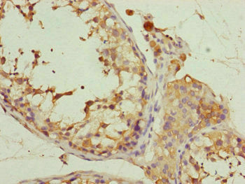 Immunohistochemistry of paraffin-embedded human testis tissue using EIF3M Antibody at dilution of 1:100Rabbit anti-Human EIF3M Polyclonal Antibody