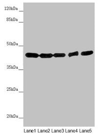 Western blot  | All lanes: EIF3M antibody at 2.02µg/ml  | Lane 1: Hela whole cell lysate  | Lane 2: A549 whole cell lysate  | Lane 3: Mouse gonadal tissue  | Lane 4: Human placenta tissue  | Lane 5: Mouse brain tissue  | Secondary  | Goat polyclonal to rabbit IgG at 1/10000 dilution  | Predicted band size: 43, 28 kDa  | Observed band size: 43 kDaRabbit anti-Human EIF3M Polyclonal Antibody