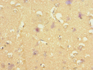 Immunohistochemistry of paraffin-embedded human brain tissue using STRADA Antibody at dilution of 1:100Rabbit anti-Human STRADA Polyclonal Antibody