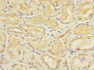 Immunohistochemistry of paraffin-embedded human kidney tissue using STRADA Antibody at dilution of 1:100Rabbit anti-Human STRADA Polyclonal Antibody