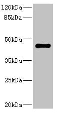 Western blot | All lanes: STRADA antibody IgG at 1.98μg/ml + Rat heart tissue | Secondary | Goat polyclonal to rabbit IgG at 1/10000 dilution | Predicted band size: 49, 39, 44, 34, 42, 35 kDa | Observed band size: 49 kDaRabbit anti-Human STRADA Polyclonal Antibody