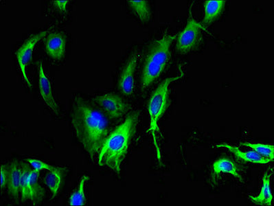 Immunofluorescent analysis of Hela cells using the antibody at dilution of 1:100 and Alexa Fluor 488-congugated AffiniPure Goat Anti-Rabbit IgG(H+L)
