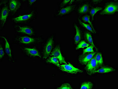 Immunofluorescent analysis of Hela cells using the antibody at dilution of 1:100 and Alexa Fluor 488-congugated AffiniPure Goat Anti-Rabbit IgG(H+L)