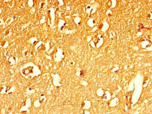 Immunohistochemistry of paraffin-embedded human brain tissue using MFSD5 Antibody at dilution of 1:100