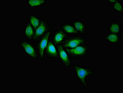 Immunofluorescent analysis of A549 cells using AAGAB Antibody at dilution of 1:100 and Alexa Fluor 488-congugated AffiniPure Goat Anti-Rabbit IgG(H+L)