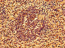Immunohistochemistry of paraffin-embedded human spleen tissue using the antibody at dilution of 1:100