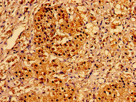 Immunohistochemistry of paraffin-embedded human adrenal gland tissue using AAGAB Antibody at dilution of 1:100