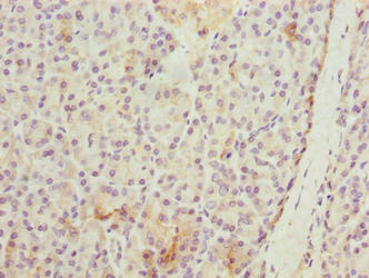 Immunohistochemistry of paraffin-embedded human pancreatic tissue using WDR74 Antibody at dilution of 1:100Rabbit anti-Human WDR74 Polyclonal Antibody
