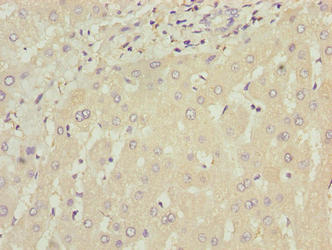 Immunohistochemistry of paraffin-embedded human liver tissue using WDR74 Antibody at dilution of 1:100Rabbit anti-Human WDR74 Polyclonal Antibody