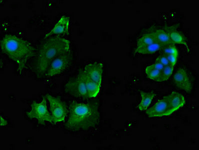 Immunofluorescent analysis of MCF-7 cells using CYP20A1 Antibody at dilution of 1:100 and Alexa Fluor 488-congugated AffiniPure Goat Anti-Rabbit IgG(H+L)Rabbit anti-Human CYP20A1 Polyclonal Antibody