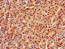 Immunohistochemistry of paraffin-embedded human adrenal gland tissue using CYP20A1 Antibody at dilution of 1:100Rabbit anti-Human CYP20A1 Polyclonal Antibody