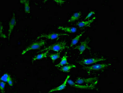 Immunofluorescent analysis of Hela cells using CASP12 Antibody at dilution of 1:100 and Alexa Fluor 488-congugated AffiniPure Goat Anti-Rabbit IgG(H+L)