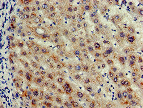 Immunohistochemistry of paraffin-embedded human liver tissue using CASP12 Antibody at dilution of 1:100