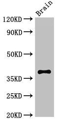 Western Blot | Positive WB detected in: Mouse brain tissue | All lanes: CASP12 antibody at 2.7μg/ml | Secondary | Goat polyclonal to rabbit IgG at 1/50000 dilution | Predicted band size: 39, 20, 30 kDa | Observed band size: 39 kDa
