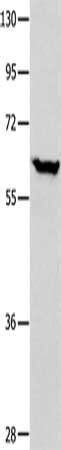 Gel: 10%SDS-PAGE, Lysate: 40 μg, Lane: Human seminoma tissue, Primary antibody: DNAJC7 Antibody(DNAJC7 Antibody) at dilution 1/400, Secondary antibody: Goat anti rabbit IgG at 1/8000 dilution, Exposure time: 20 secondsRabbit anti-Human DNAJC7 Polyclonal Antibody