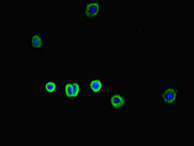 Immunofluorescent analysis of HepG2 cells using SLC30A10 Antibody at dilution of 1:100 and Alexa Fluor 488-congugated AffiniPure Goat Anti-Rabbit IgG(H+L)Rabbit anti-Human SLC30A10 Polyclonal Antibody
