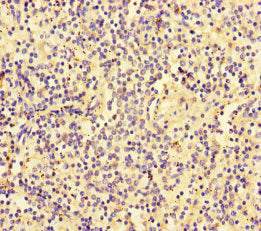 Immunohistochemistry of paraffin-embedded human spleen tissue using SLC30A10 Antibody at dilution of 1:100Rabbit anti-Human SLC30A10 Polyclonal Antibody