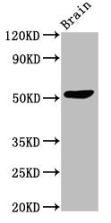 Western Blot | Positive WB detected in: Mouse brain tissue | All lanes: SLC30A10 antibody at 3μg/ml | Secondary | Goat polyclonal to rabbit IgG at 1/50000 dilution | Predicted band size: 53, 27, 25 kDa | Observed band size: 53 kDaRabbit anti-Human SLC30A10 Polyclonal Antibody